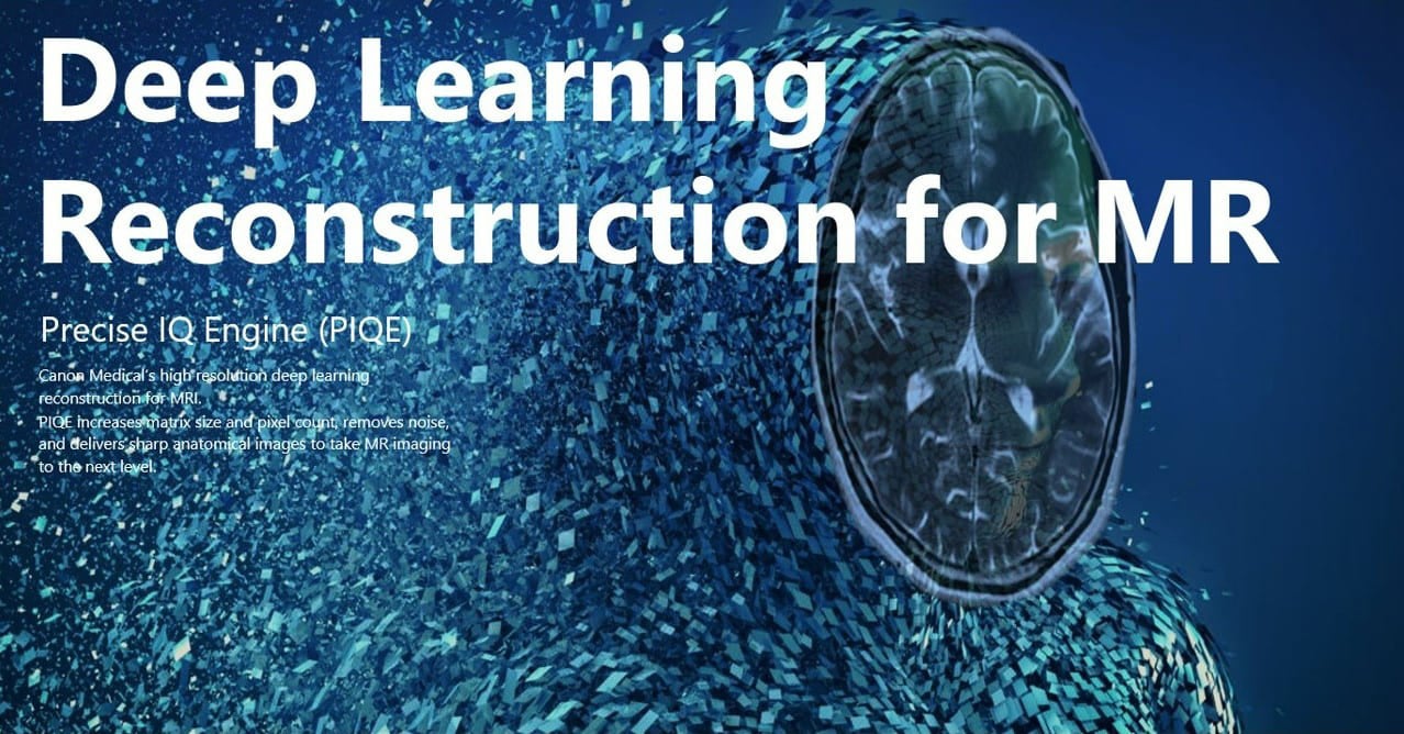 deep learning reconstruction for mr